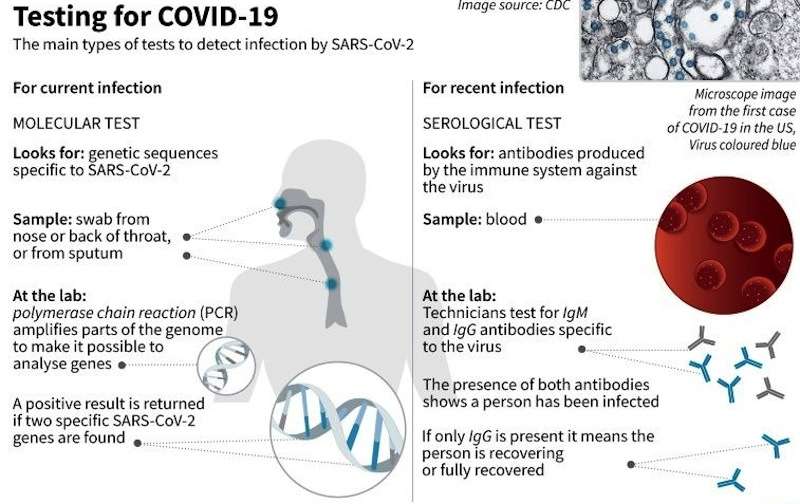 Fifth Patient Infected with Coronavirus Receiving Treatment in Isolation